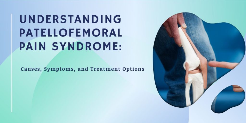 Understanding Patellofemoral Pain Syndrome Causes, Symptoms, and Treatment Options